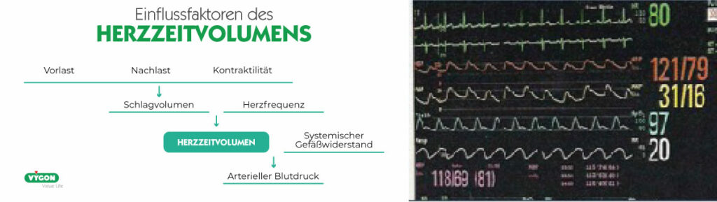 Einflussfaktoren-Herzzeitvolumen