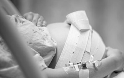 DIE ROLLE DER EPIDURALANÄSTHESIE BEI DER GEBURT