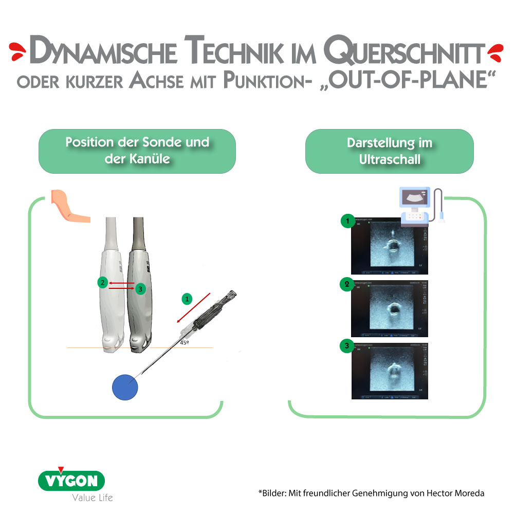 DYNAMISCHE-TECHNIK-IM-QUERSCHNITT