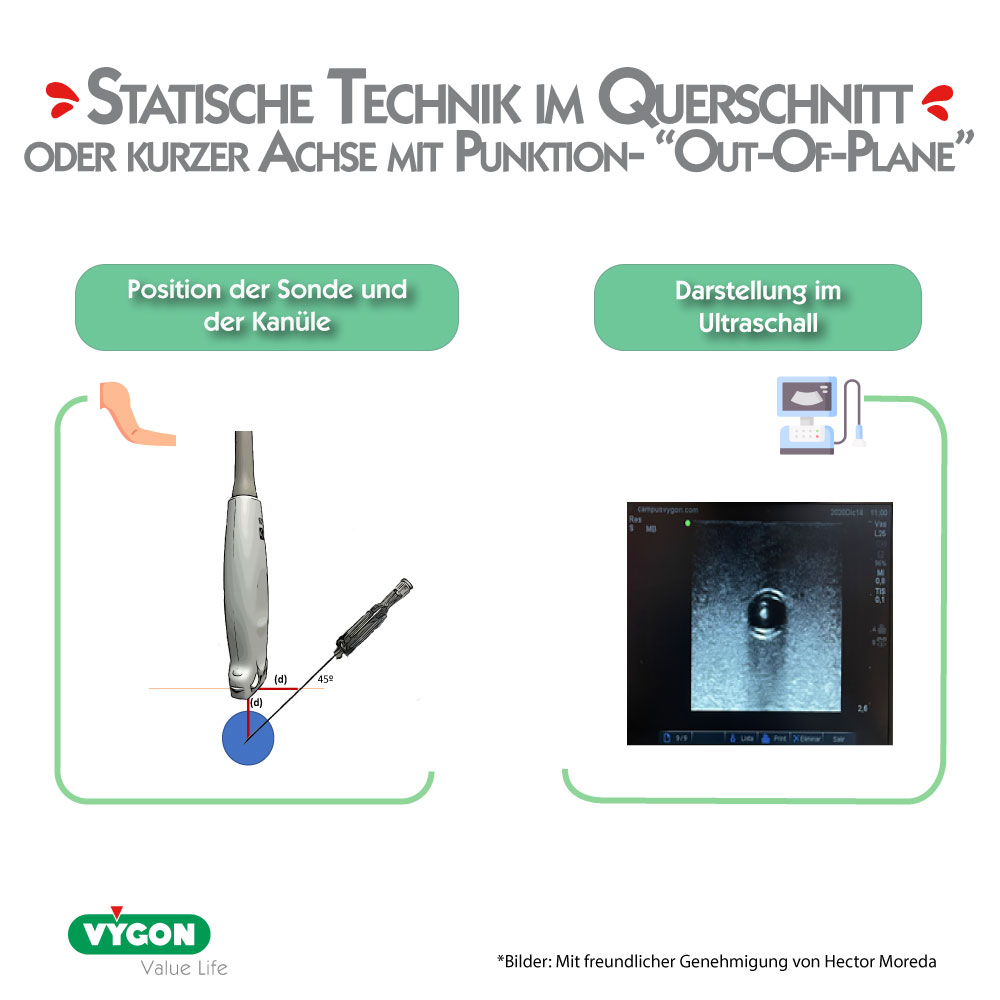 STATISCHE-TECHNIK-IM-QUERSCHNITT