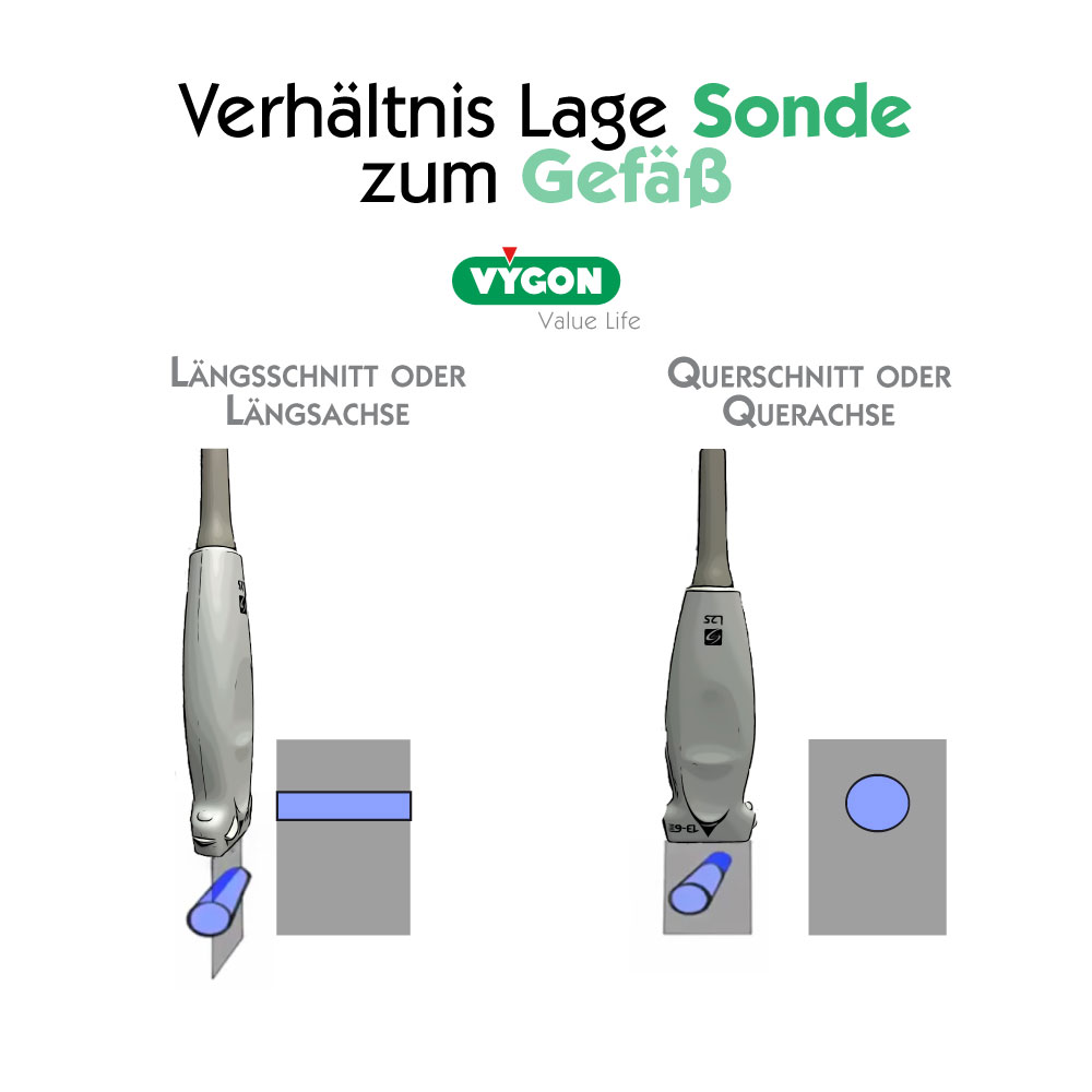 Verhältnis-Lage-Sonde